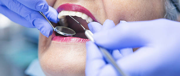 Best Emergency Dental Care for Broken or Chipped Teeth in Chula Vista, CA